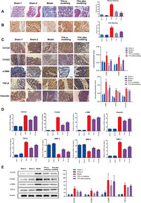 Total Flavone of Abelmoschus manihot Ameliorates TNBS-Induced Colonic Fibrosis by Regulating Th17/Treg Balance and Reducing Extracellular Matrix